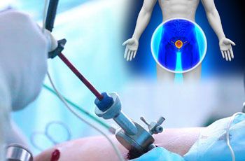 chirurgie urologique à bas prix meilleurs urologistes meilleurs hôpitaux kerala