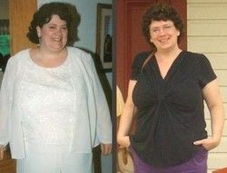 Laparoscopic Bariatric Surgery Experience in India